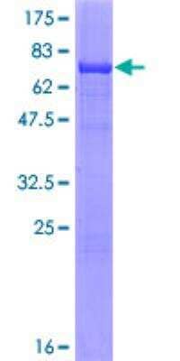 SDS-PAGE: Recombinant Human Adenylosuccinate Synthase GST (N-Term) Protein [H00000159-P02]