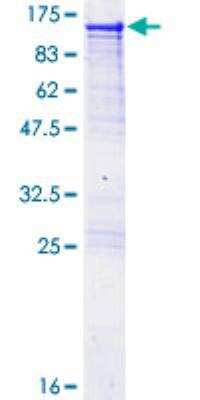 SDS-PAGE: Recombinant Human Alanyl tRNA synthetase GST (N-Term) Protein [H00000016-P01]