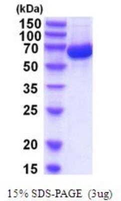 SDS-PAGE: Recombinant Human Albumin His Protein [NBP2-52084]