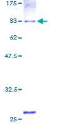 SDS-PAGE: Recombinant Human Aldehyde dehydrogenase 5 GST (N-Term) Protein [H00000219-P01]