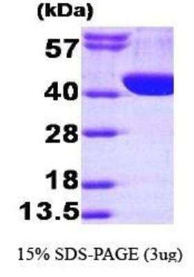 SDS-PAGE: Recombinant Human Aldolase A His Protein [NBP1-40395]