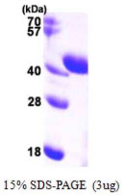 SDS-PAGE: Recombinant Human Aldolase C His Protein [NBP1-51050]