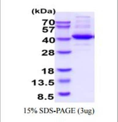 SDS-PAGE: Recombinant Human Aldolase C Protein [NBP2-49693]