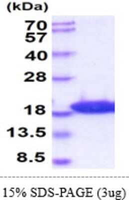 SDS-PAGE: Recombinant Mouse LC3B His Protein [NBP2-61172]