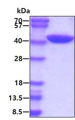 SDS-PAGE: Recombinant Human Alix His Protein [NBP1-40401]