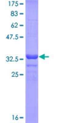 SDS-PAGE: Recombinant Human Alkaline Phosphatase, Intestinal GST (N-Term) Protein [H00000248-Q01]