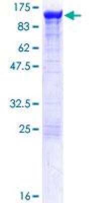 SDS-PAGE: Recombinant Human Alpha Actinin 4 GST (N-Term) Protein [H00000081-P01]