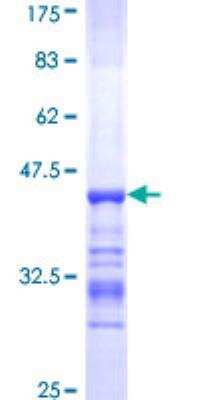 SDS-PAGE: Recombinant Human Alpha Actinin 4 GST (N-Term) Protein [H00000081-Q01]