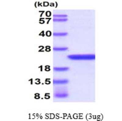 SDS-PAGE: Recombinant Human AlphaB Crystallin/CRYAB Protein [NBC1-18352]