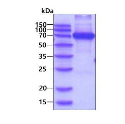 SDS-PAGE: Recombinant Human Aminopeptidase P1/XPNPEP1 His Protein [NBP2-52110]