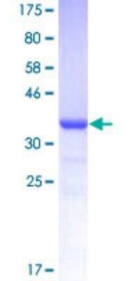 SDS-PAGE: Recombinant Human Androgen R/NR3C4 GST (N-Term) Protein [H00000367-Q01]