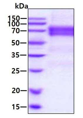 SDS-PAGE: Recombinant Human Angiopoietin-2 His Protein [NBP2-77507]