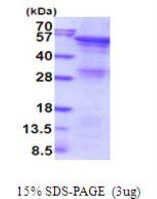 SDS-PAGE: Recombinant Human Angiopoietin-like Protein 2/ANGPTL2 His Protein [NBP2-51983]