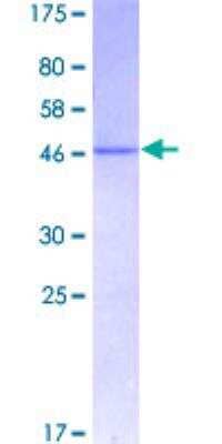 SDS-PAGE: Recombinant Human Ankyrin 1 GST (N-Term) Protein [H00000286-P01]