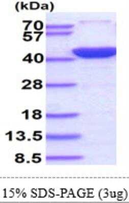 SDS-PAGE: Recombinant Human Annexin A2 His Protein [NBP1-37086]