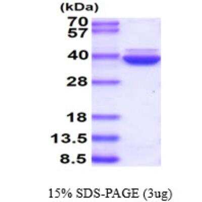 SDS-PAGE: Recombinant Human Annexin A8/ANXA8 His Protein [NBP1-48328]