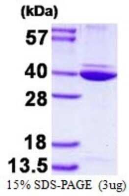 SDS-PAGE: Recombinant Human Annexin A8 like2 His Protein [NBP1-98931]