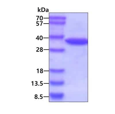 SDS-PAGE: Recombinant Human Annexin V Protein [NBP1-30265]