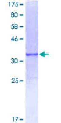 SDS-PAGE: Recombinant Human Apolipoprotein C-II/ApoC2 GST (N-Term) Protein [H00000344-P01]