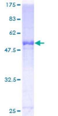 SDS-PAGE: Recombinant Human Apolipoprotein F GST (N-Term) Protein [H00000319-P01]