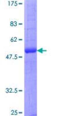 SDS-PAGE: Recombinant Human Aquaporin-2 GST (N-Term) Protein [H00000359-P01]