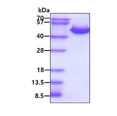 SDS-PAGE: Recombinant Human Argininosuccinate Synthase His Protein [NBP1-45289]