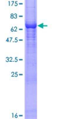 SDS-PAGE: Recombinant Human Arrestin 3 GST (N-Term) Protein [H00000407-P02]