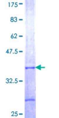 SDS-PAGE: Recombinant Human Arrestin 3 GST (N-Term) Protein [H00000407-Q01]