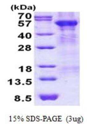 SDS-PAGE: Recombinant Human Arylsulfatase A/ARSA His Protein [NBP2-22695]