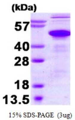 SDS-PAGE: Recombinant Human Ataxin-3 Protein [NBP1-50828]