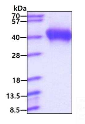 SDS-PAGE: Recombinant Human B7-2/CD86 His Protein [NBP2-77486]