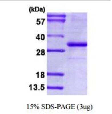 SDS-PAGE: Recombinant Human PD-L1 His Protein [NBP1-98984]