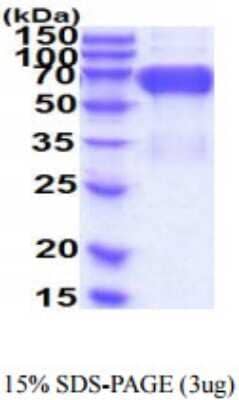 SDS-PAGE: Recombinant Human B7-H3/CD276 His Protein [NBP2-59914]