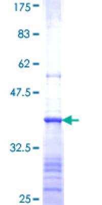 SDS-PAGE: Recombinant Human BAAT GST (N-Term) Protein [H00000570-Q01]