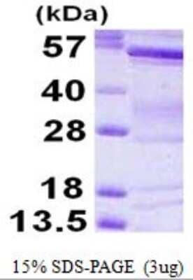 SDS-PAGE: Recombinant Human BAIAP2 His Protein [NBP1-78872]