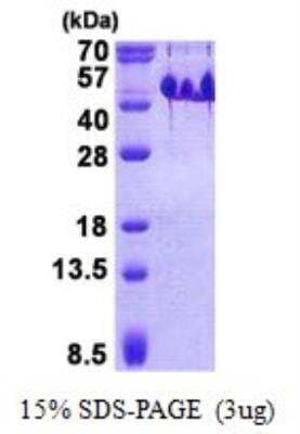 SDS-PAGE: Recombinant Human BASP1 His Protein [NBP2-22717]