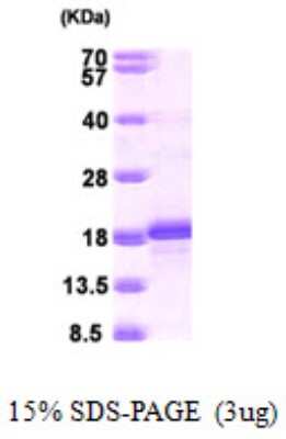 SDS-PAGE: Recombinant Human BATF His Protein [NBP1-51006]