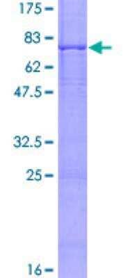 SDS-PAGE: Recombinant Human BBS1 GST (N-Term) Protein [H00000582-P01]