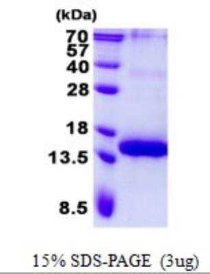 SDS-PAGE: Recombinant Human BCMA/TNFRSF17 His Protein [NBP2-22905]