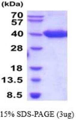 SDS-PAGE: Recombinant Human BCMA/TNFRSF17 hIgG-His Protein [NBP2-52270]