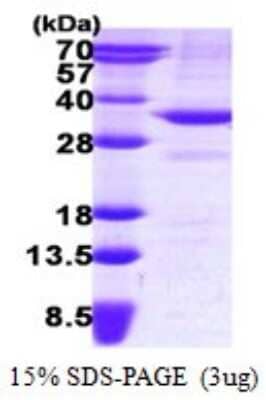 SDS-PAGE: Recombinant Human BDH1 His Protein [NBP1-78840]