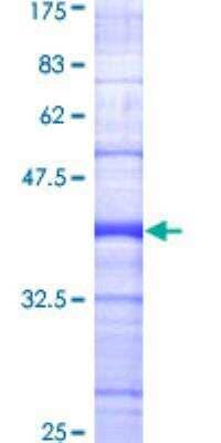 SDS-PAGE: Recombinant Human BIK GST (N-Term) Protein [H00000638-Q01]