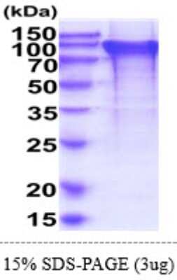 SDS-PAGE: Recombinant Human BIN2 Isoform 1 His Protein [NBP2-61975]