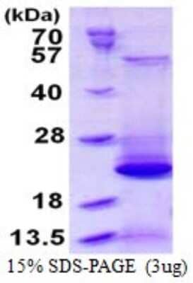 SDS-PAGE: Recombinant Human BLOC1S2 His Protein [NBP1-98999]