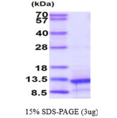 SDS-PAGE: Recombinant Human BMP-4 Protein [NBC1-19056]