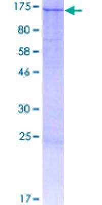 SDS-PAGE: Recombinant Human BNC1 GST (N-Term) Protein [H00000646-P01]