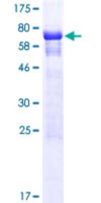 SDS-PAGE: Recombinant Human BOD1L GST (N-Term) Protein [H00259282-P01]