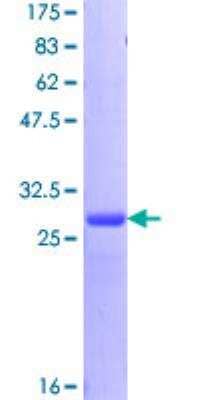 SDS-PAGE: Recombinant Human BRCA1 GST (N-Term) Protein [H00000672-P01]