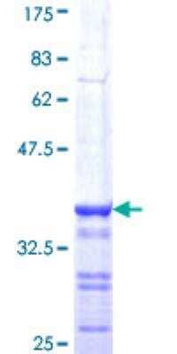 SDS-PAGE: Recombinant Human BRCA1 GST (N-Term) Protein [H00000672-Q01]