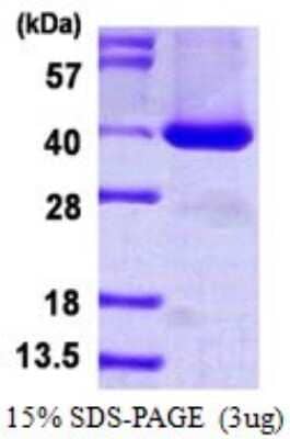 SDS-PAGE: Recombinant Human BRDG1/STAP-1 His Protein [NBP1-98975]